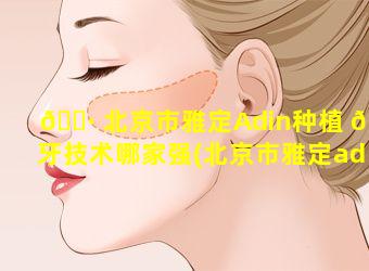 🌷 北京市雅定Adin种植 🦟 牙技术哪家强(北京市雅定adin种植牙技术哪家强)